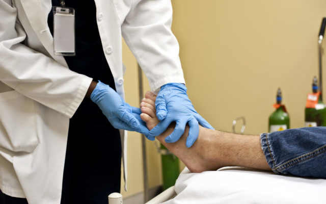 Frostbite-Like Rashes on Toes May Be a Sign of Coronavirus